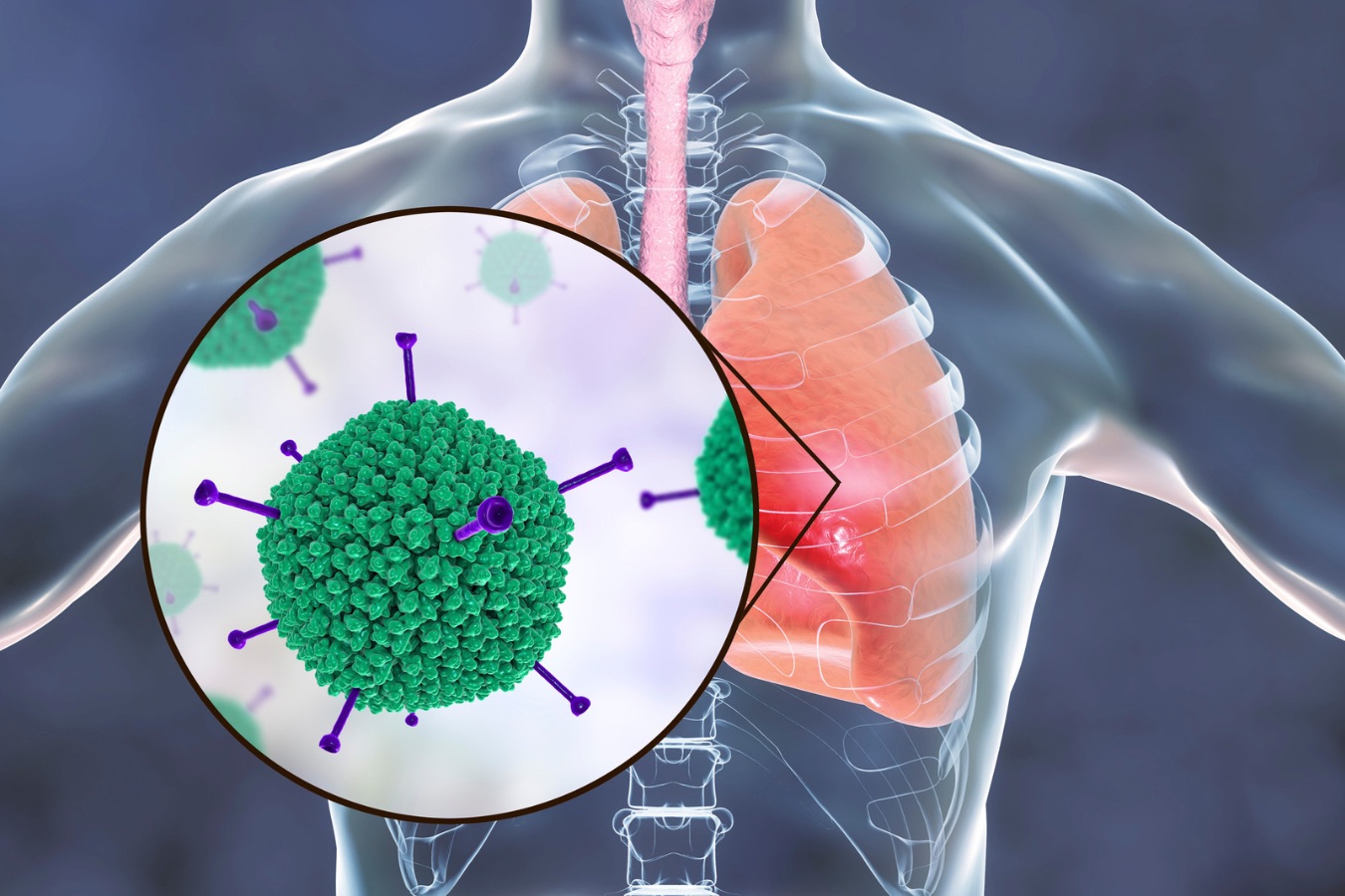 呼吸器感染症の最新治療：COVID-19後の対応と抗菌薬耐性対策